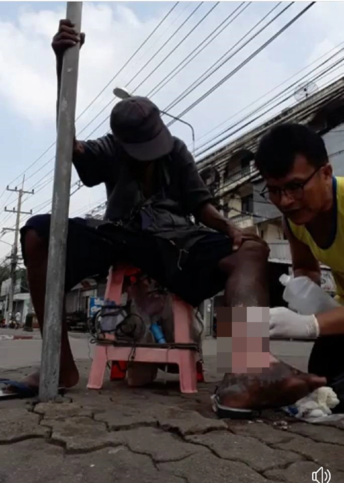 จิตอาสามันอยู่ที่ใจ!! แห่ชื่นชม หนุ่มใจงามเจอคุณลุงป่วยเป็นโรคเท้าช้างมีแผลเปื่อย รีบเข้าไปช่วยล้างแผลให้ฟรีๆโดยไม่มีท่าทีรังเกียจ (คลิป)