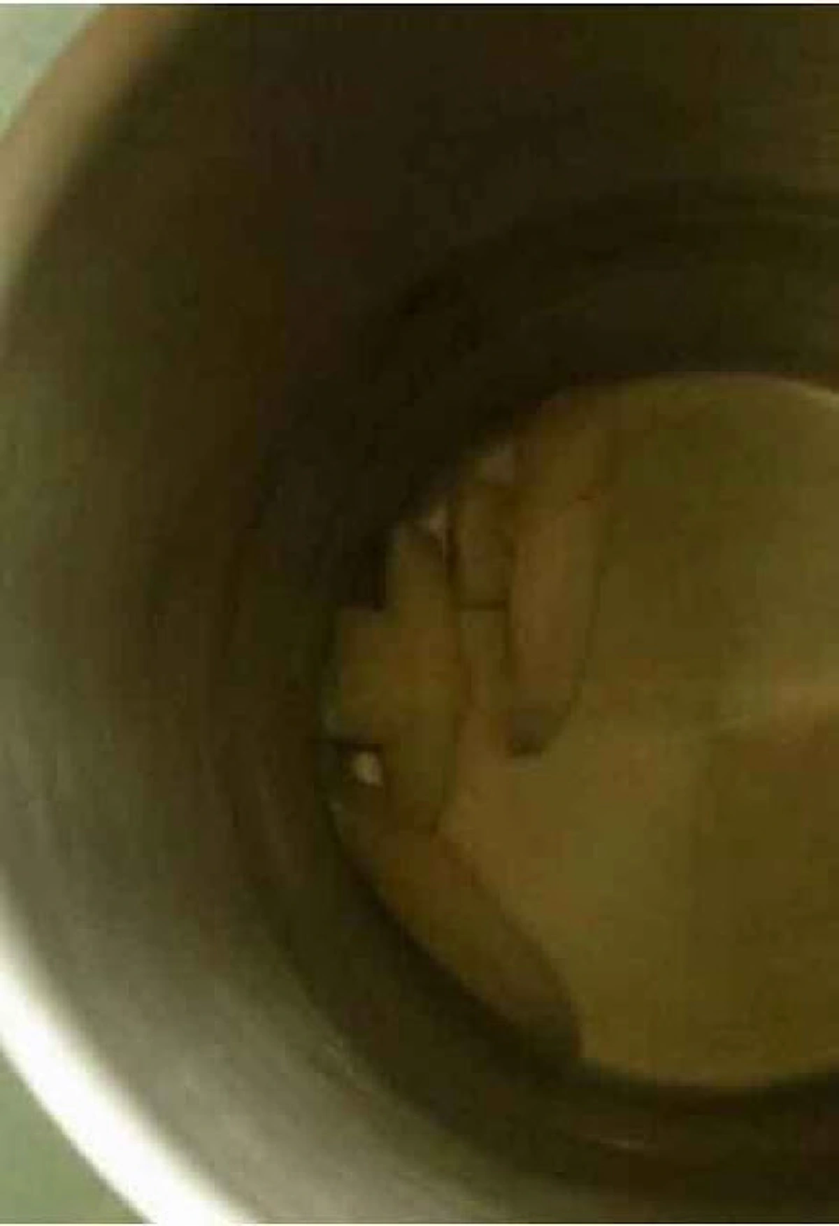 ผมนี่อึ้งไปเลย!! "ฟันหัก-หลุด" อย่าทิ้ง!! กลับเอามาต่อใหม่ได้!! ด้วยวิธีสุดทึ่ง?? บอกเลยแทบไม่เชื่อสายตาตัวเอง!!