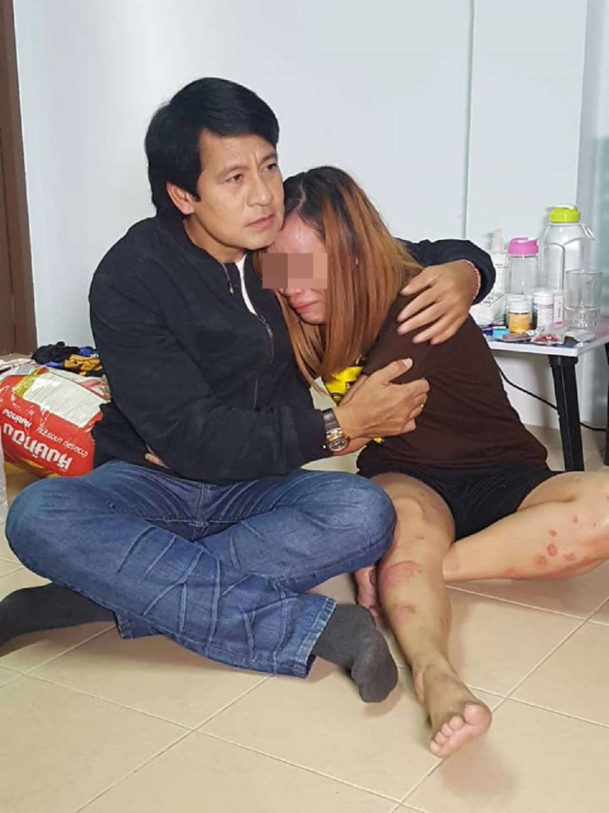 สุดสงสาร! สาววัย 27ปี ป่วยเป็นโรคสะเก็ดเงิน ผู้คนรังเกียจเพราะคิดว่าเป็นโรคเอดส์ ซ้ำ! สามีทิ้งเพราะรับไม่ได้ ต้องเลี้ยงลูก 2คนอยู่เพียงลำพัง