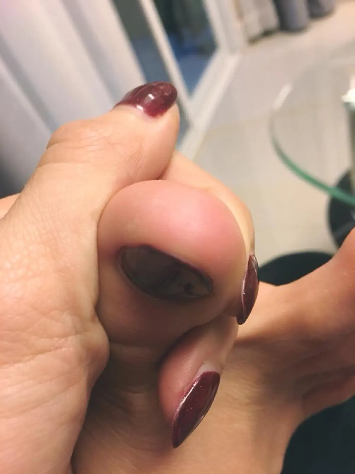 เจอเเบบนี้ก็ช็อกสิ!!!  "จ๊ะ Rsiam" เล่าเหตุการณ์สุดตกใจ ออกจากบ้านตอนกลางคืน เจอตะขาบกัด ตัวใหญ่เบ้อเริ่มเทิ่ม!!!