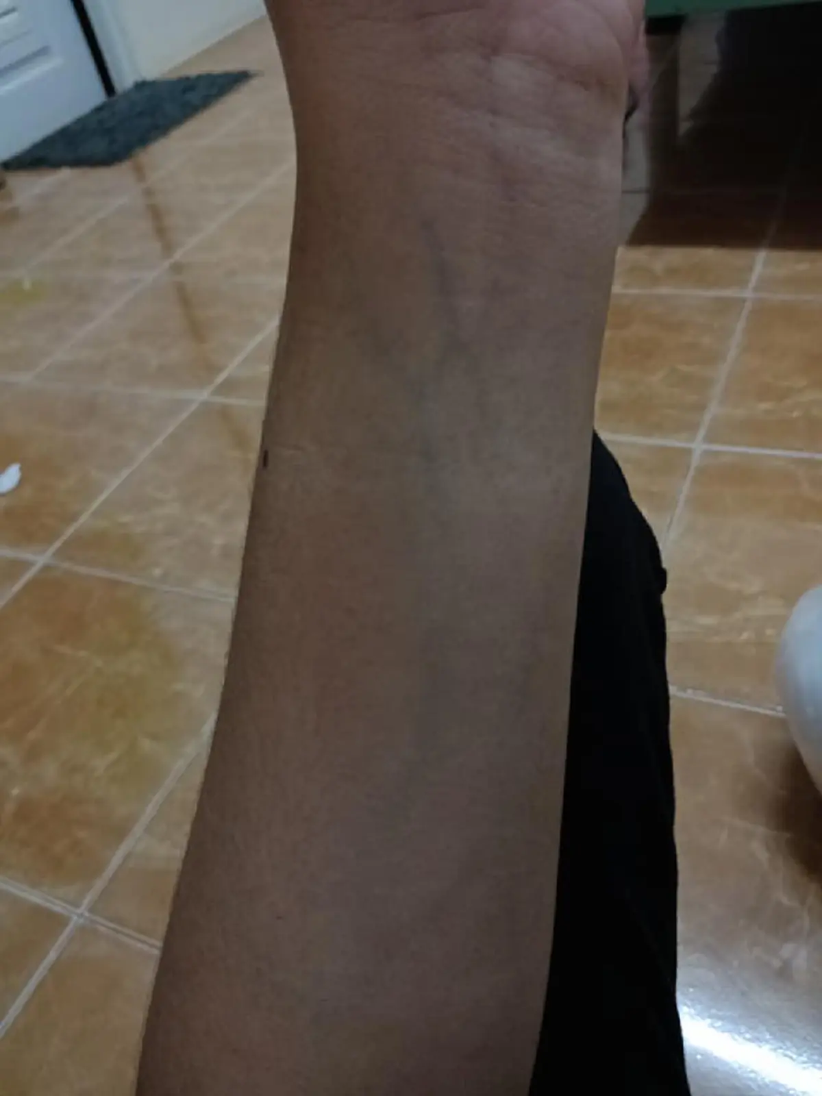 สาวแชร์ประสบการณ์ ภัยที่คุณคิดไม่ถึง!!! สำหรับคนที่ชอบดื่ม ชาเย็น ชาเขียว กาแฟ ทำร่างกายผิดปกติเกือบถึงแก่ชีวิต!!!