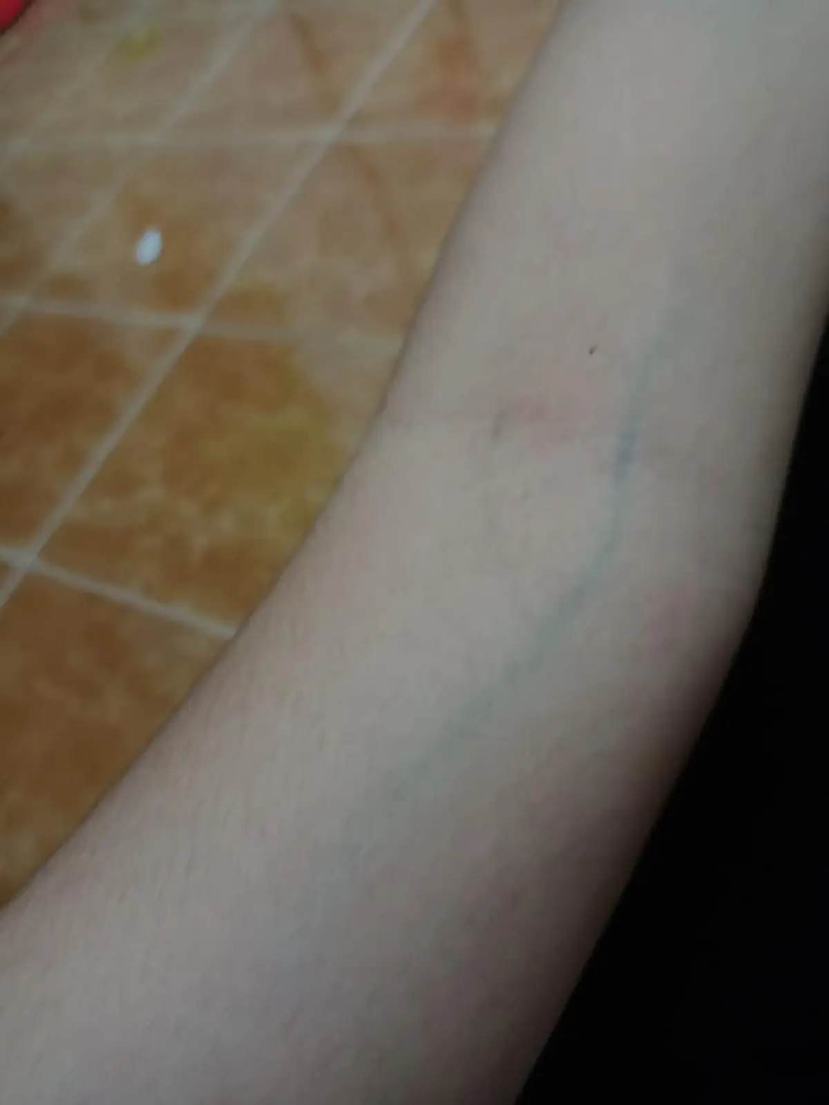 สาวแชร์ประสบการณ์ ภัยที่คุณคิดไม่ถึง!!! สำหรับคนที่ชอบดื่ม ชาเย็น ชาเขียว กาแฟ ทำร่างกายผิดปกติเกือบถึงแก่ชีวิต!!!