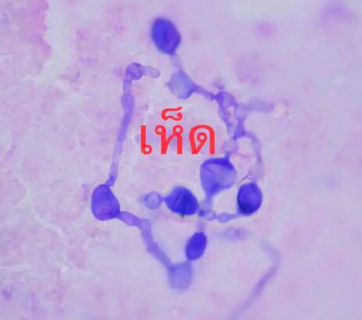 น่ากลัวต้องอ่าน!! คุณหมอเตือน การสูดดมเห็ดสด และอยู่ใกล้นกพิราบ นั้นอันตราย