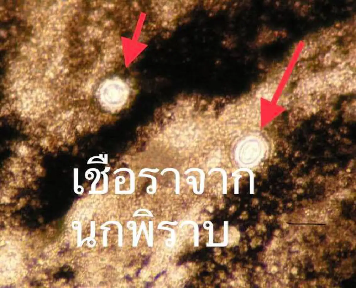 น่ากลัวต้องอ่าน!! คุณหมอเตือน การสูดดมเห็ดสด และอยู่ใกล้นกพิราบ นั้นอันตราย