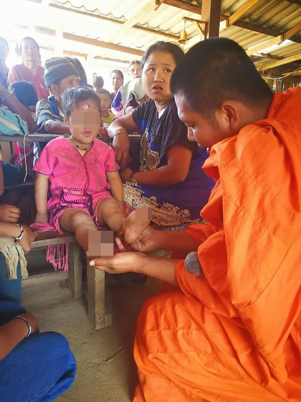 พระสงฆ์วอนช่วยแชร์เป็นบุญ..เพื่อช่วยเหลือหนูน้อยชาวเขา วัย 6 ขวบ ป่วยโรคร้ายให้ได้รับการรักษา หากปล่อยไว้แผลก็จะกัดกินอวัยวะจนหมดสิ้น (คลิป)