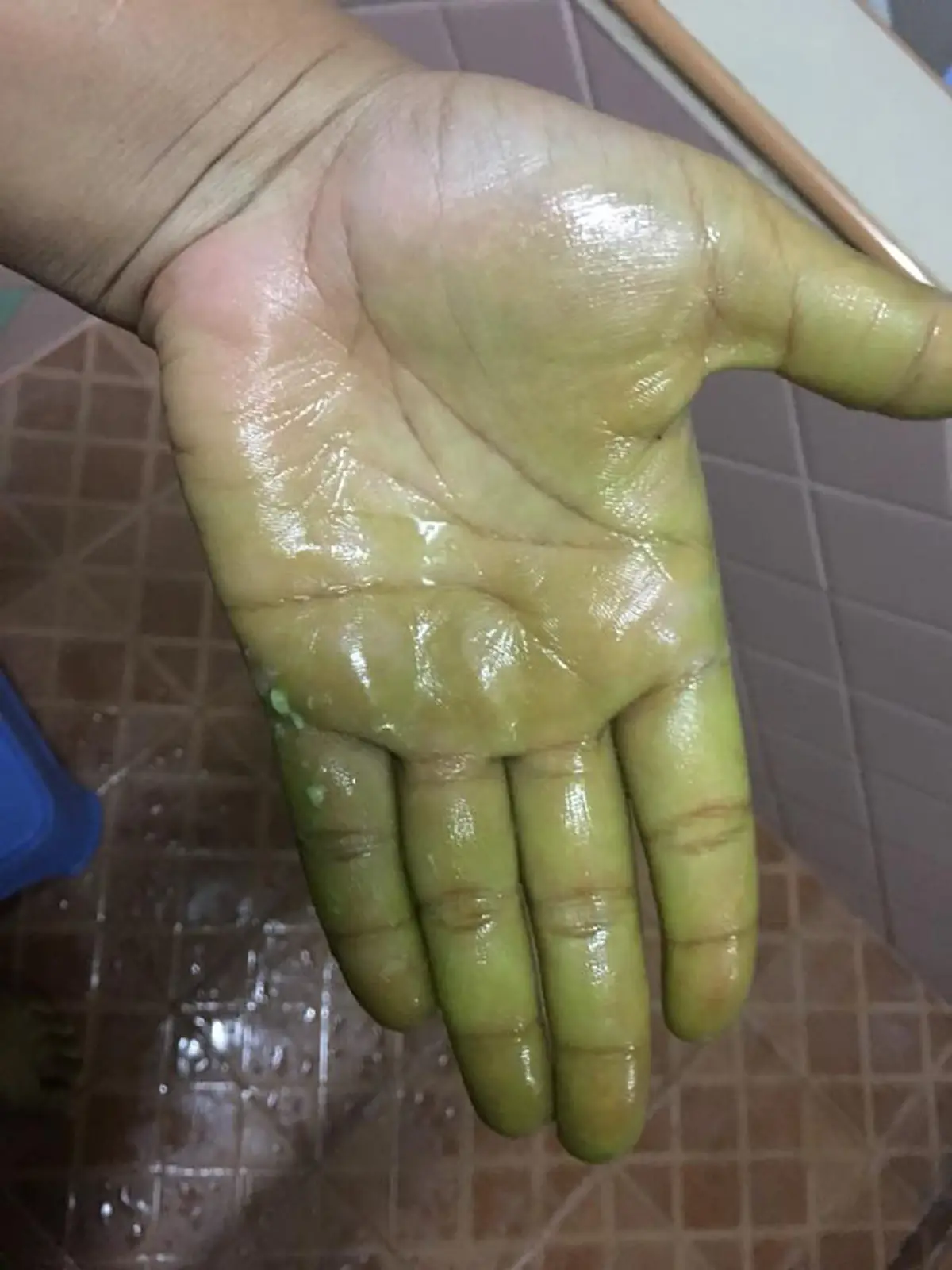 แฉ !!! "ยาลดความอ้วน" ละลายน้ำจับตัวเป็นก้อน สีเขียวติดมือ (คลิป)