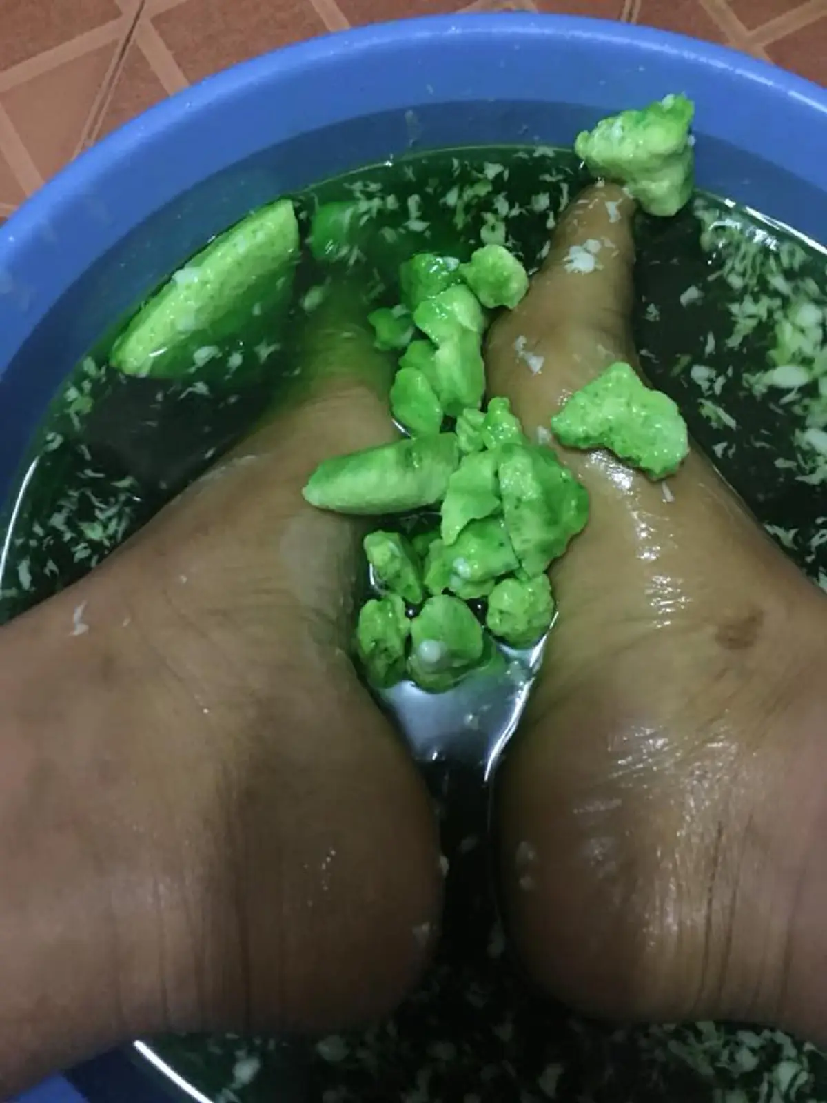 แฉ !!! "ยาลดความอ้วน" ละลายน้ำจับตัวเป็นก้อน สีเขียวติดมือ (คลิป)