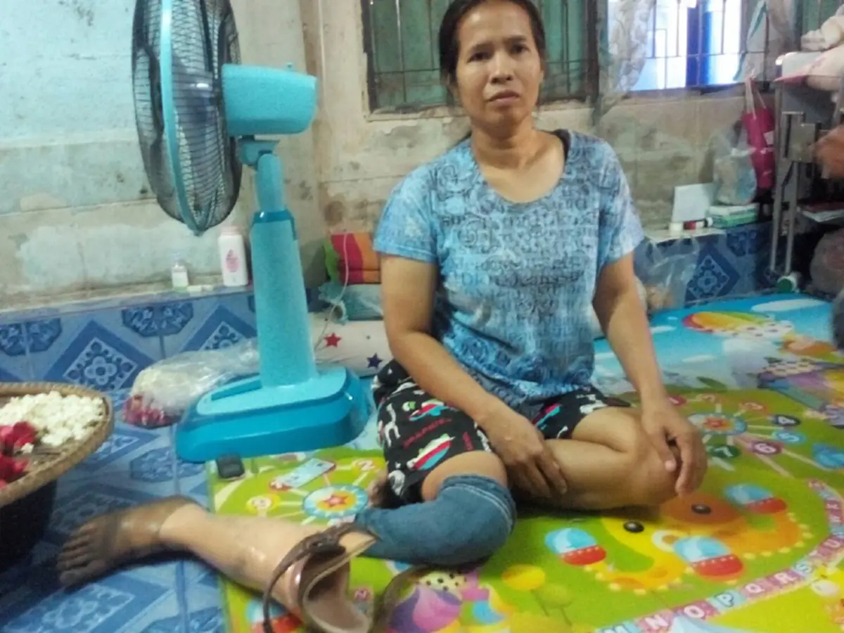 สาวขาขาดสู้ชีวิต ร้อยพวงมาลัยเลี้ยงลูก-สามีป่วยมะเร็งระยะสุดท้าย เผยปมชีวิตสุดเวทนาก่อนและหลังขาดขา 1คน สู้เพื่ออีกหลายชีวิตที่รอคอย (คลิป)