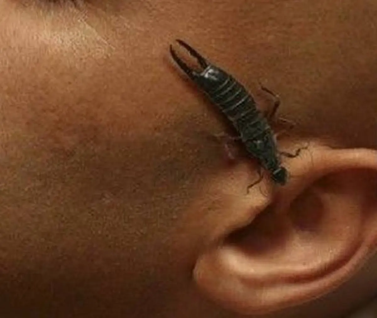 #คนมีเด็กอย่าเลื่อนผ่าน!! "แมลงเข้าหู" เกิดขึ้นได้ทุกเวลา มาดูวิธีปฐมพยาบาลเบื้องต้นง่าย ๆ ที่คุณสามารถทำได้เพื่อความปลอดภัย!!