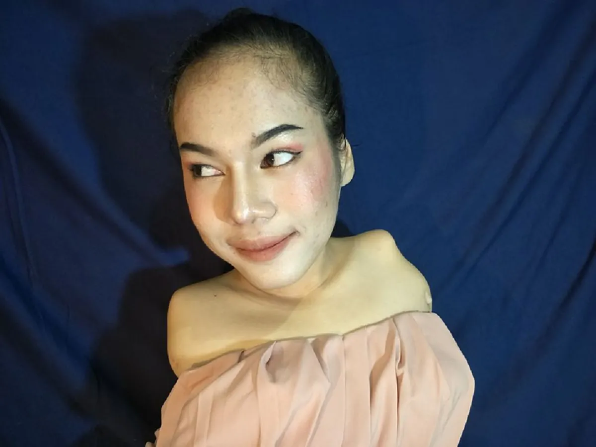 กำลังใจ!! สาวพิการไร้แขน ขาไม่เท่ากันกระดูกคดงอหวิดดับหลายรอบครั้งหนึ่งทั้งบ้านเหลือเงิน 300 แต่ไม่คิดท้อสู้จนเป็น &quot;บิวตี้ บล็อกเกอร์&quot;(คลิป)
