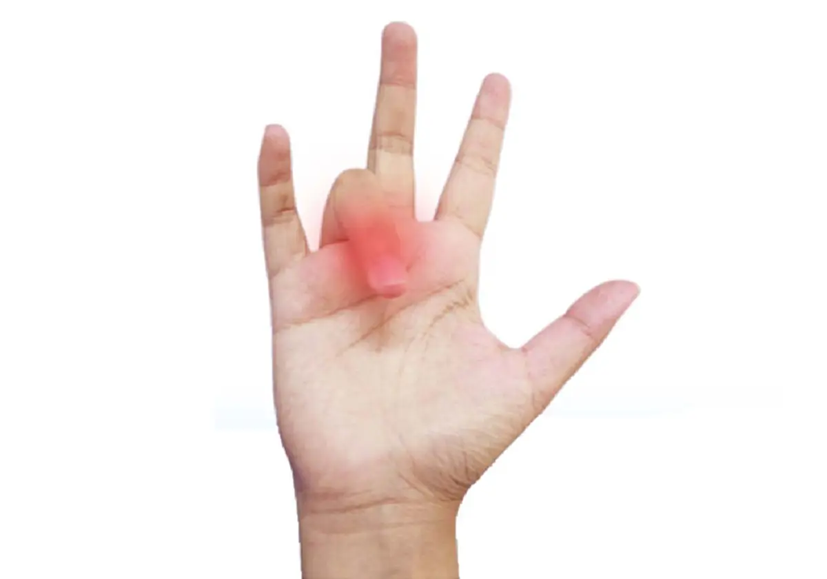 ภูมิปัญญาง่ายๆ แก้นิ้วล็อก และหินปูนที่ข้อกระดูก ลองดูวิธีนี้ !! ฝ่ามือที่ชาดีขึ้นประมาณ 80% จริงๆ ไม่ได้โม้!!