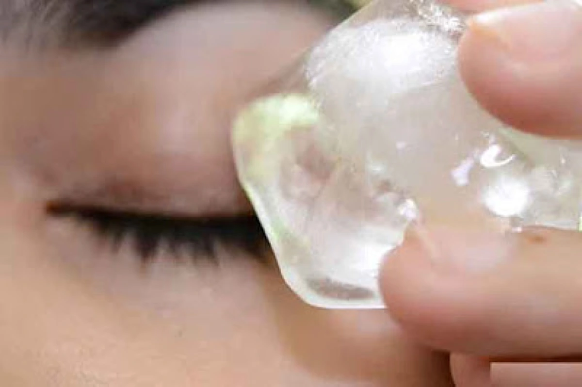 วิธีรักษาอาการผึ้งต่อย