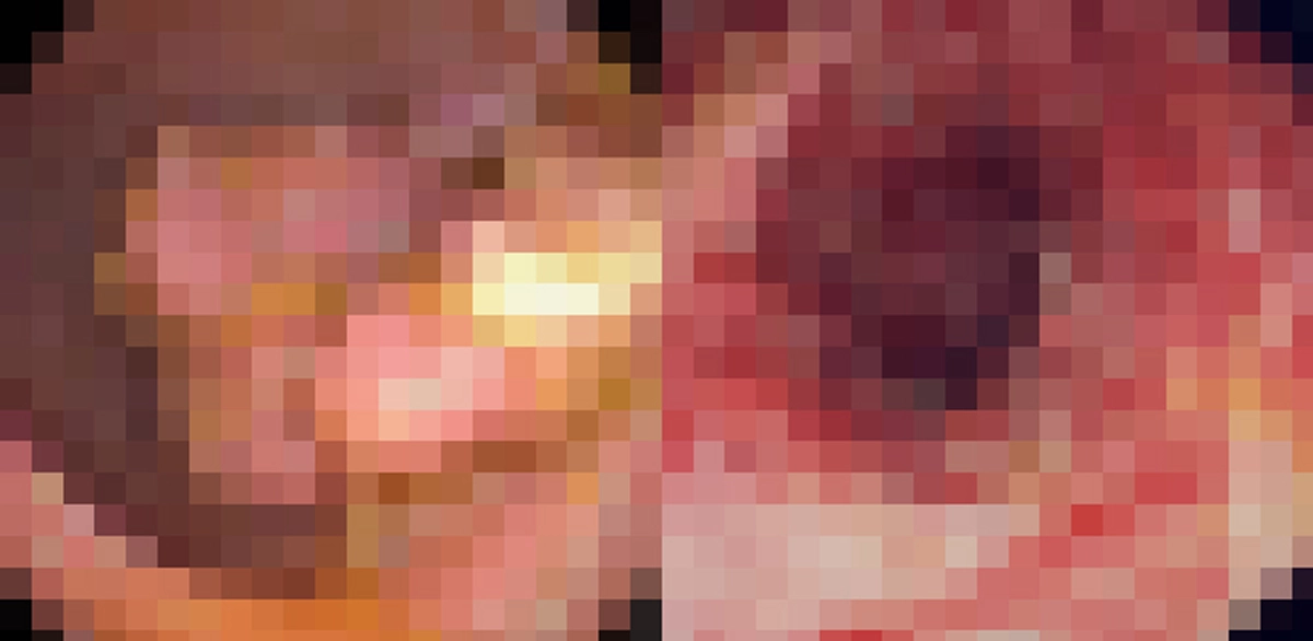 คนทำงานอ่านด่วนๆ!!! มะเร็งลำไส้ เพชฌฆาตในเงามืด โรคร้ายที่ต้องระวัง!!!