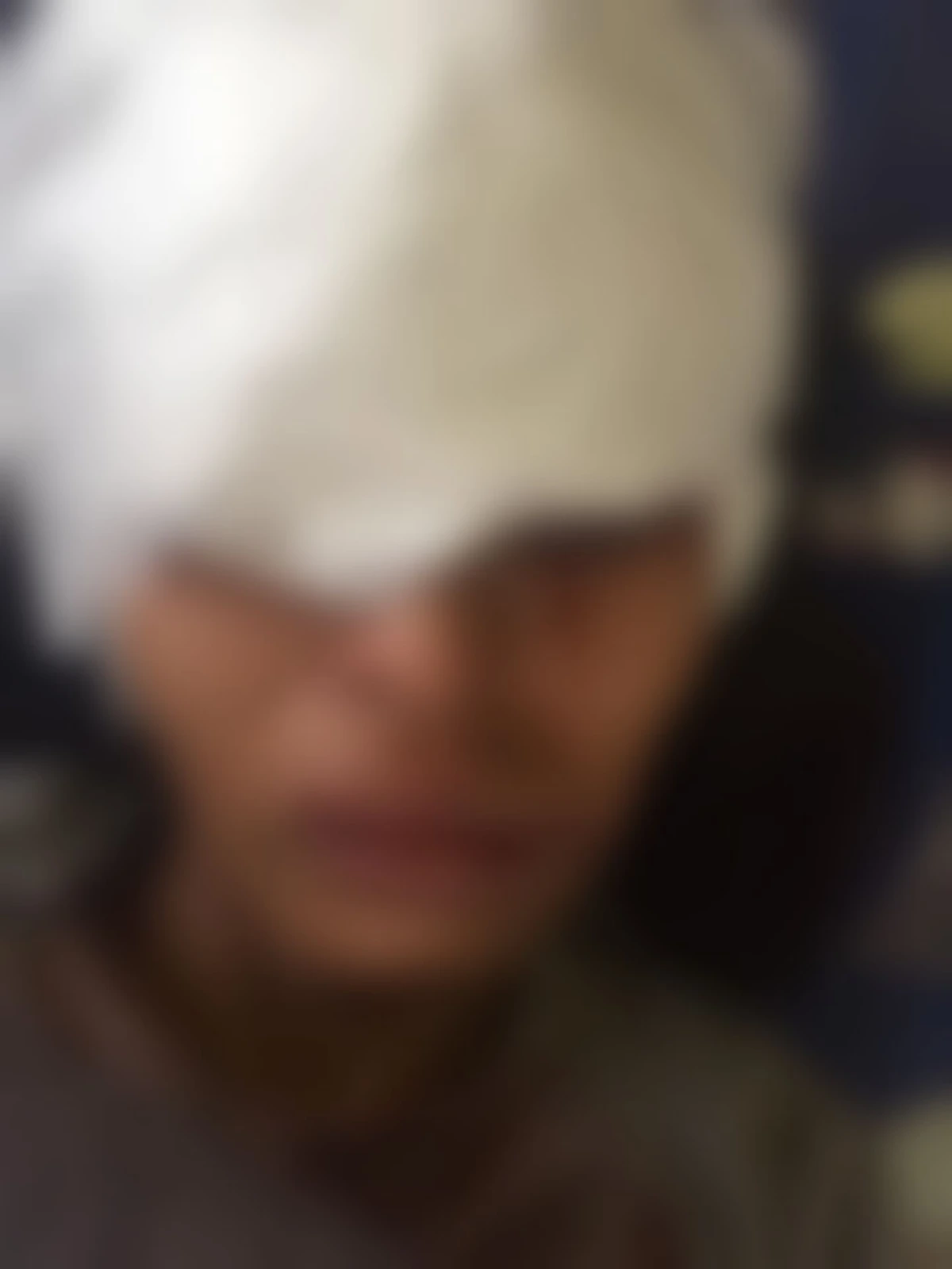 สาวขับรถไปชนเสาไฟ กระจกรถหน้าแตก กระจกบาททั้งหน้า 