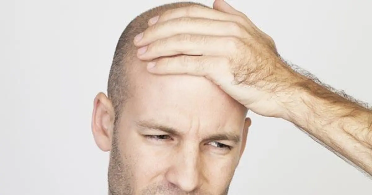 ไขข้อสงสัยที่มีมานาน เผยชัด จริงหรือไม่ ใส่หมวกนานๆแล้วทำให้หัวล้าน!