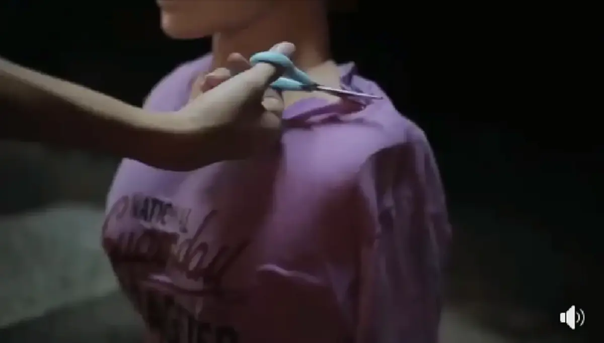 มันจะไม่สายเกินแก้  !!! โดนสาด "น้ำกรด"  ห้ามล้างด้วยน้ำทันที...แต่มีวิธีเบื้องต้นง่ายๆ