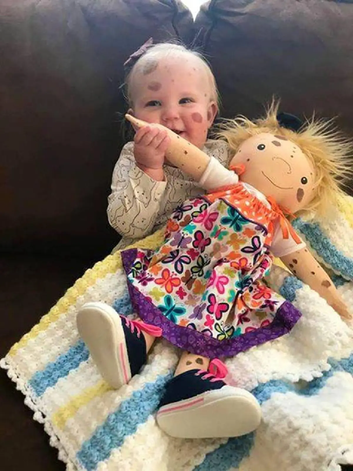 ผู้หญิงคนหนึ่งจัดแคมเปญ"A Doll Like Me" ทำตุ๊กตาให้หนูน้อยที่มีความพิเศษทางร่างกาย เพื่อให้พวกเค้าเห็นว่า คุณพิเศษในแบบที่คุณเป็น