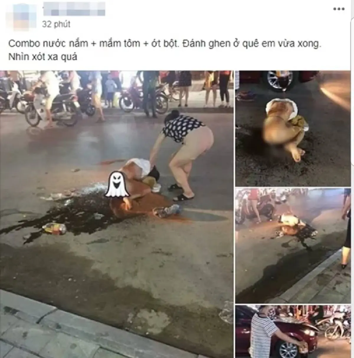 โหดเหี้ยมเกินมนุษย์ !! เผยภาพล่าสุด "กิ๊กสาว" หลังโดน "ภรรยาหลวง" ราดน้ำปลาโรยพริกป่น แผลเต็มตัว สภาพเละไม่เหลือชิ้นดี !! (ชมภาพ)