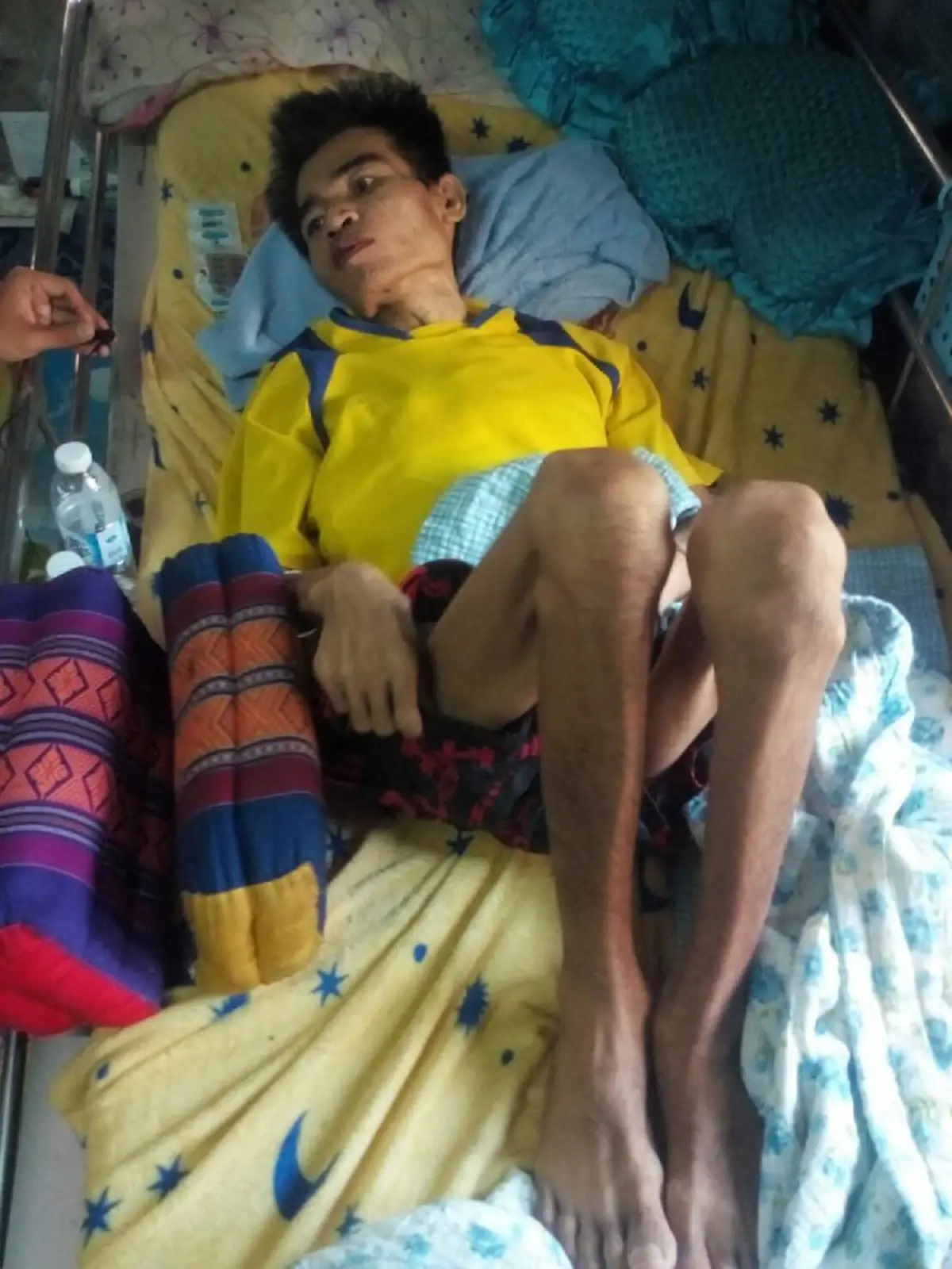 สาวขาขาดสู้ชีวิต ร้อยพวงมาลัยเลี้ยงลูก-สามีป่วยมะเร็งระยะสุดท้าย เผยปมชีวิตสุดเวทนาก่อนและหลังขาดขา 1คน สู้เพื่ออีกหลายชีวิตที่รอคอย (คลิป)