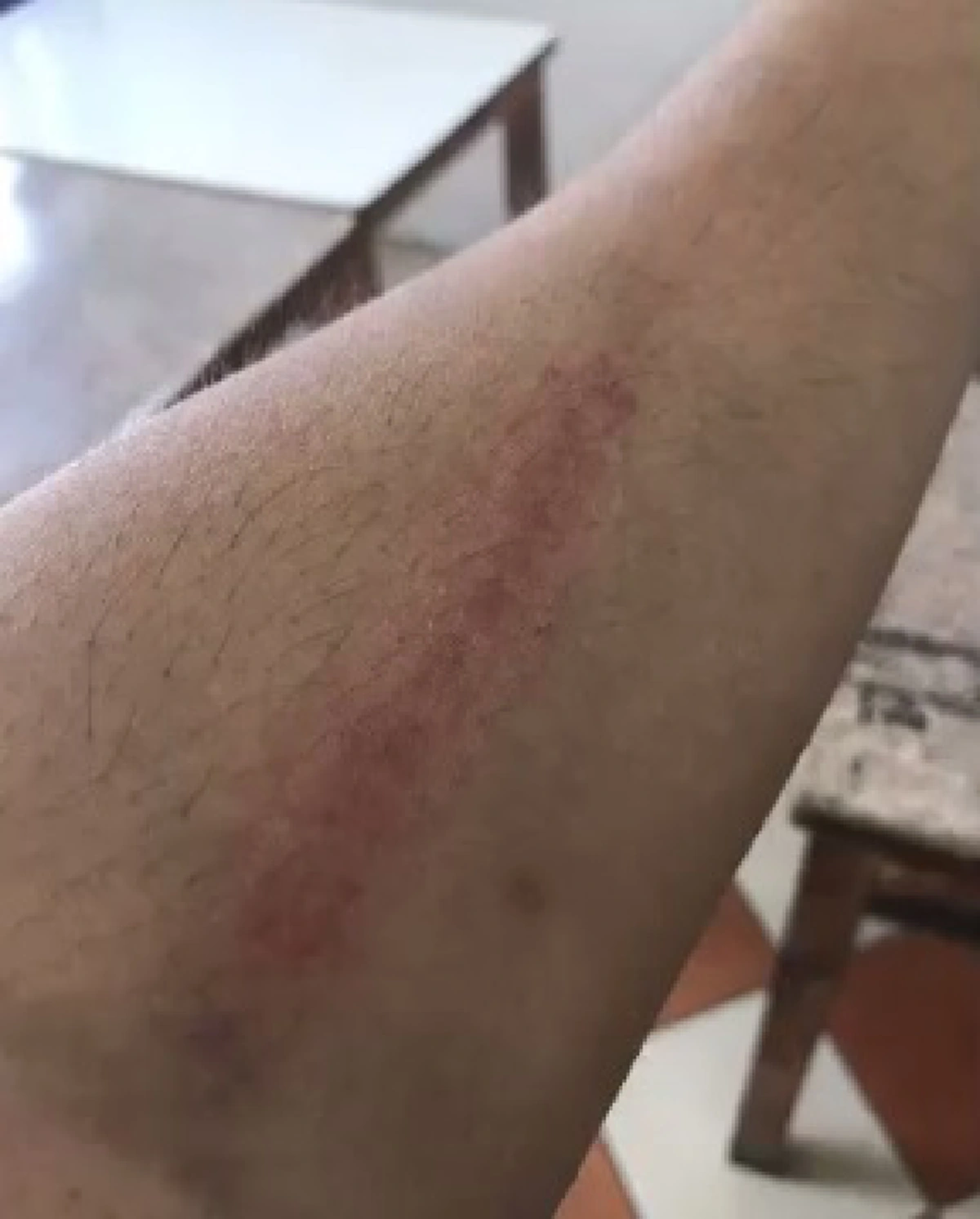 ยอมไม่ได้..ทำเกินไป!!ครูสอนภาษาอังกฤษโวยแหลกโดนตร.เชียงใหม่ซุ่มจับเมา พุ่งเเผงเหล็กสกัดรถล้มเจ็บตัว !?