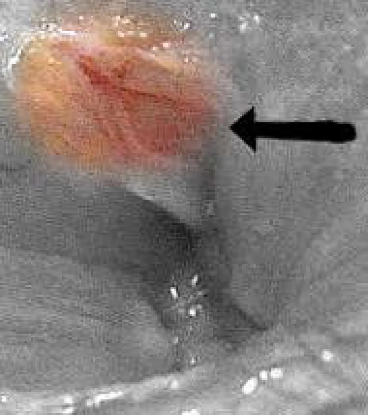 ไม่อยากตายอ่านด่วน!!! สัญญาณเตือนของร่างกาย!! อาการปวดท้องขวาไม่ใช่เรื่องเล็ก อ่านก่อนสาย!!!