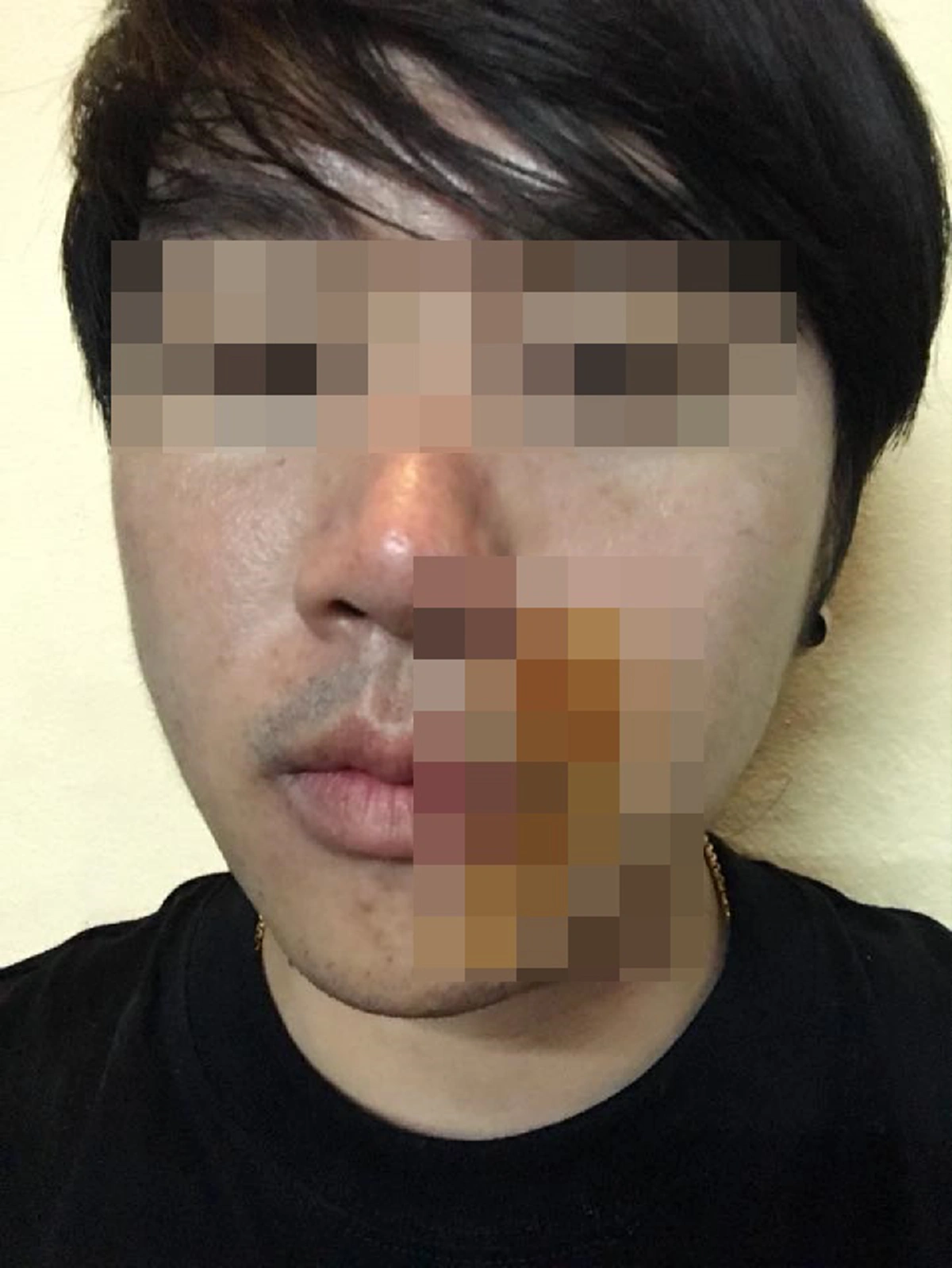 ฟังให้ครบด้าน สาวโต้เดือดโซเชียลถล่มด่าทำร้ายนักท่องเที่ยวฝรั่ง ยันหลักฐานพี่ชายโดนทำร้ายก่อน