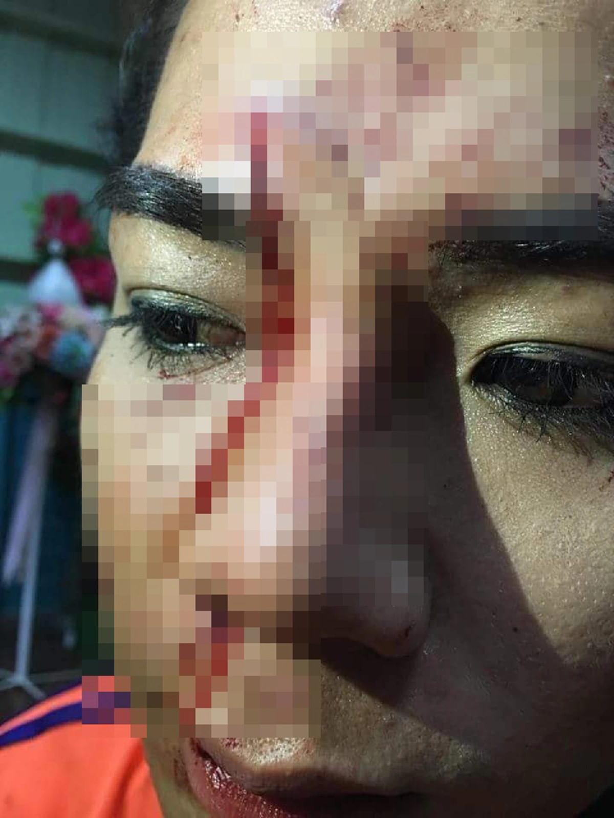 วงการครูเดือด เพจดังเปิดภาพครูอัตราจ้างสาวสอง อ้างโดนครูร.ร.เดียวกันยกครอบครัวรุมตบตีเลือดอาบ