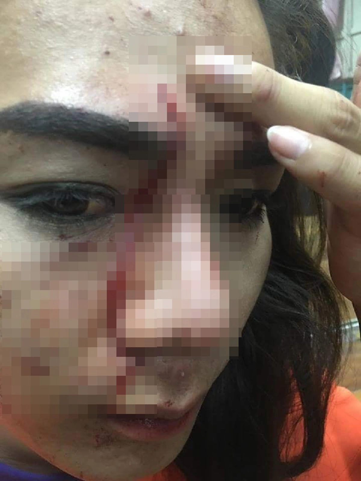 วงการครูเดือด เพจดังเปิดภาพครูอัตราจ้างสาวสอง อ้างโดนครูร.ร.เดียวกันยกครอบครัวรุมตบตีเลือดอาบ