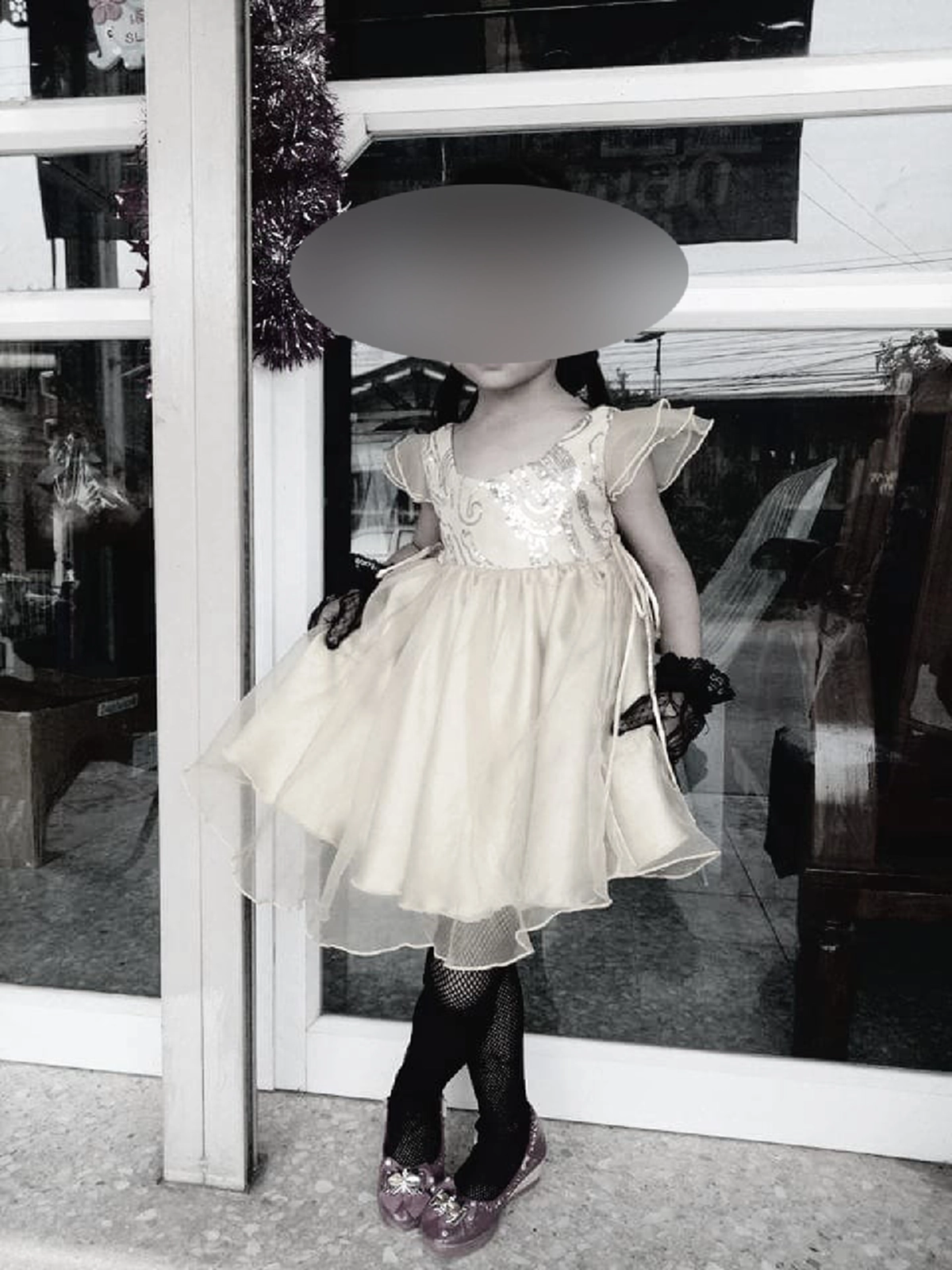 สยอง! สุนัขรุมขย้ำเด็ก4ขวบ เสียชีวิต