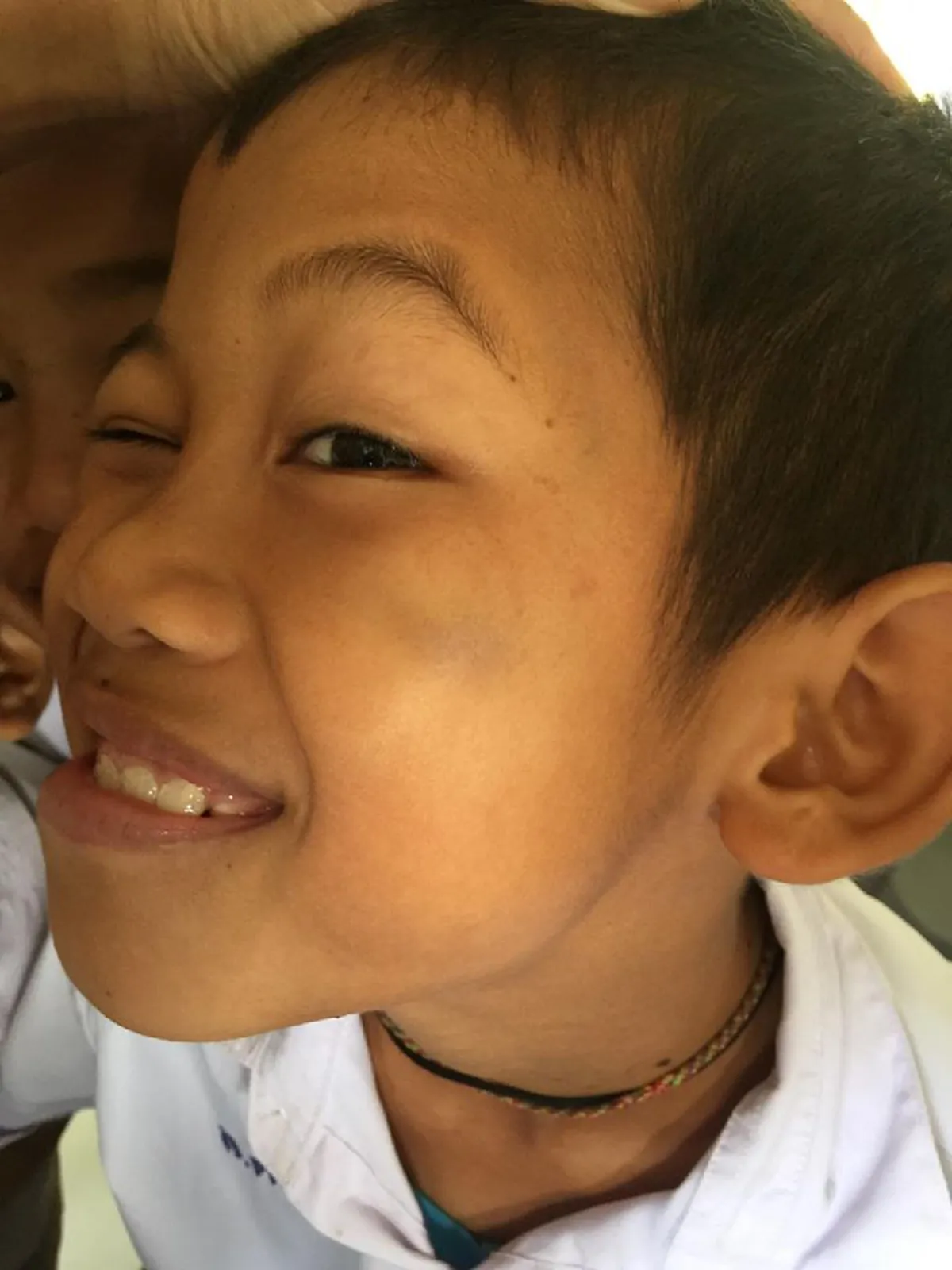 ยอดวิวกว่า4แสน หนุ่มน้อยตอบคำถามครู หน้าเขียวช้ำไปโดนอะไรมา