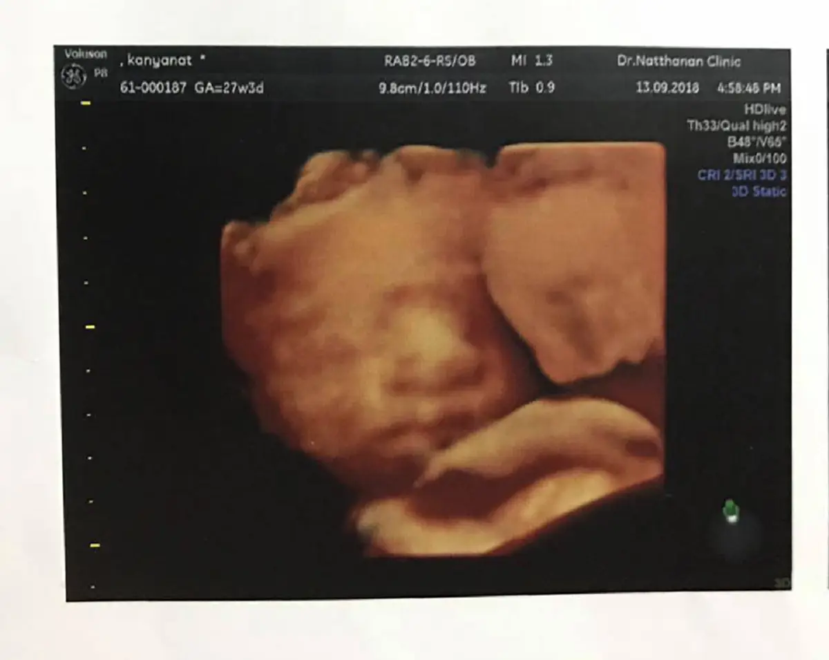 หนุ่มโพสต์สะเทือนใจ หลัง ภรรยาครรภ์เป็นพิษจนเสียชีวิต หมอพูดเพียงสั้นๆ อื้ม...ปัดความรับผิดชอบหรือไม่