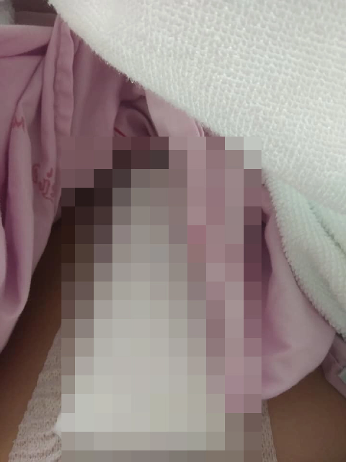 สาวโพสต์อุทาหรณ์ปวดประจำเดือน หลังตรวจพบเนื้องอกต้องตัดรังไข่ทั้งสองข้างทิ้ง