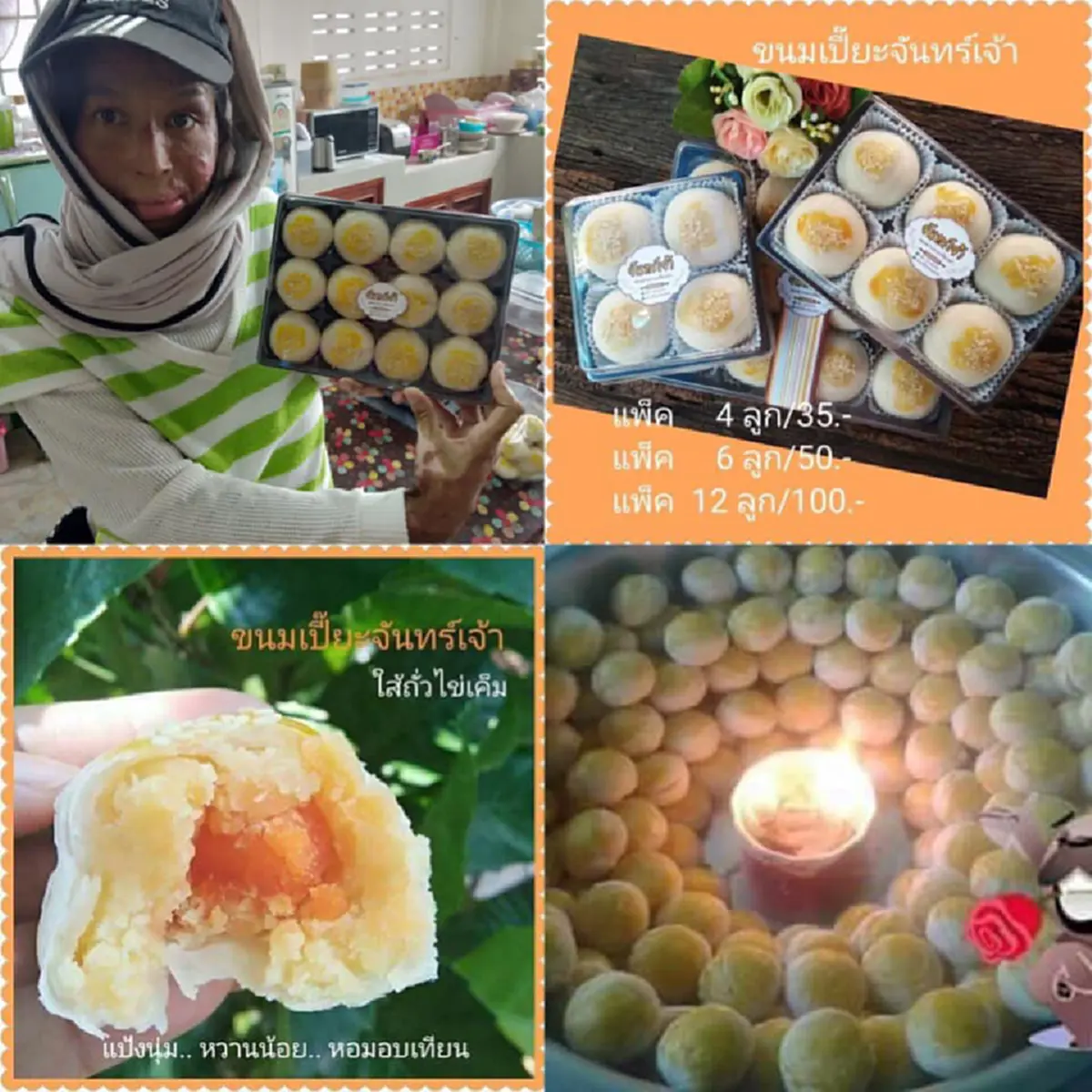 “ร้านค้าเพื่อลูก” สาวพิการถูกสามีใช้น้ำมันราดตัวแล้วจุดไฟเผาทั้งเป็น ลุกขึ้นมาต่อสู้กับอาการบาดเจ็บที่เหลืออยู่เพื่อลูกน้อยวัย 6 ขวบ