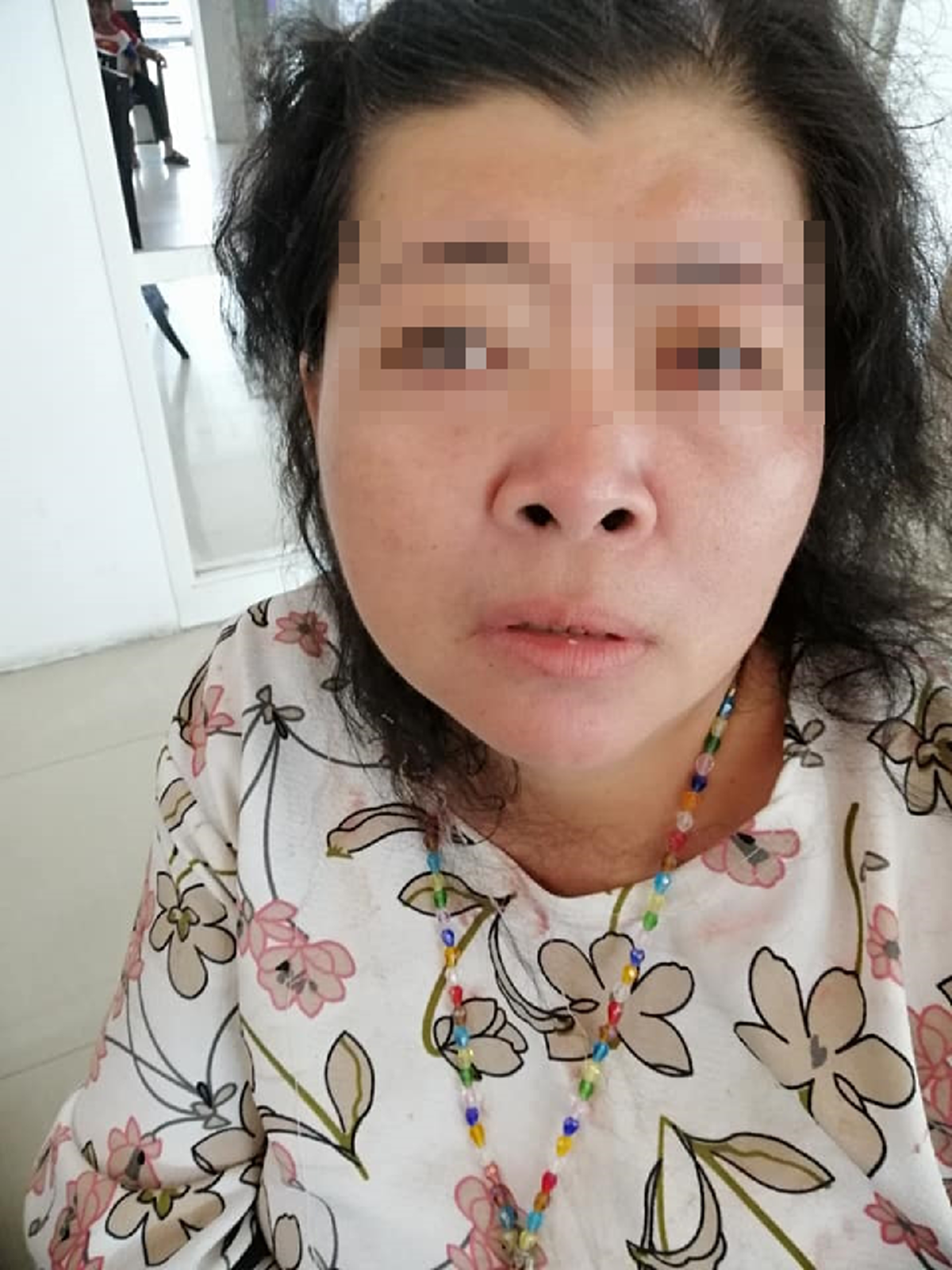 สาวร้องทุกข์ครอบครัวถูกเพื่อนบ้านรังแก ทะเลาะจอดรถขวางขั้นทำร้ายชกต่อย