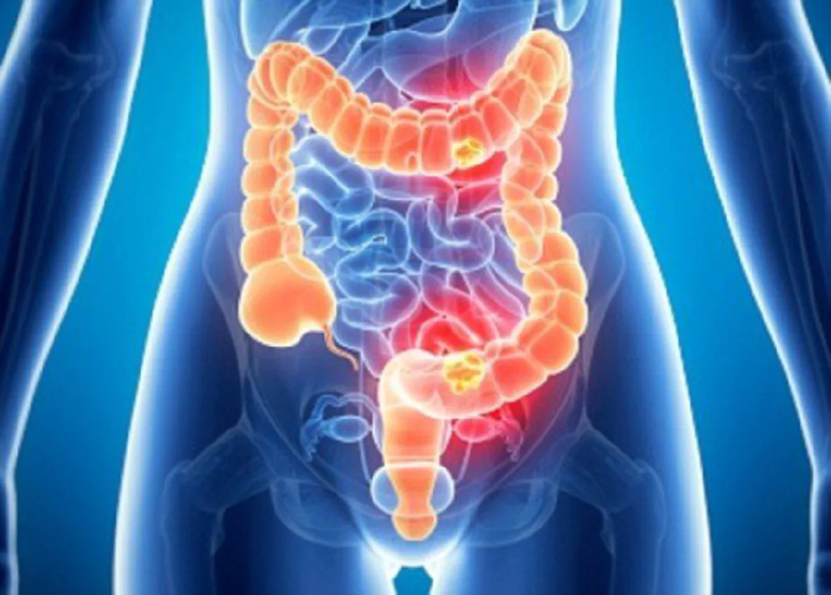 “โนโรไวรัส” หวัดลงกระเพาะ ท้องเสีย-อาเจียนรุนแรงถึงเสียชีวิตได้