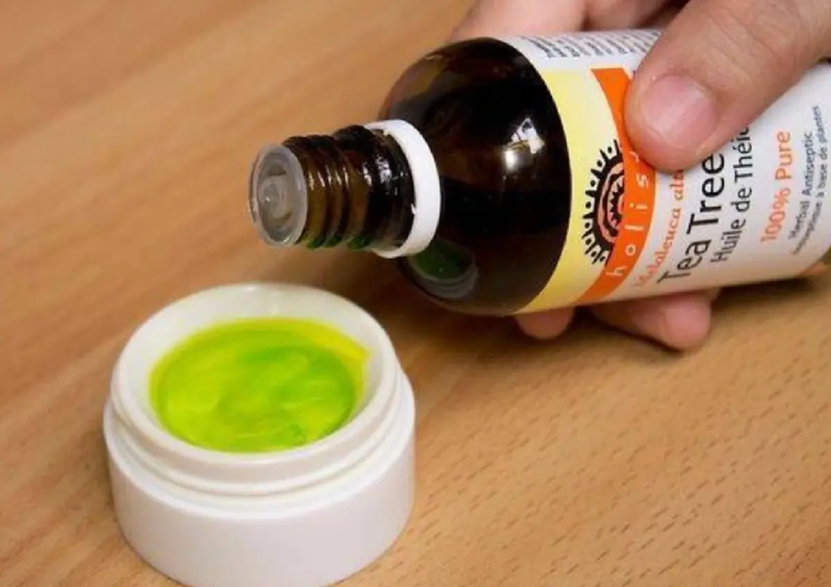 เคล็ดลับ!! "วิธีกำจัดเหา" สูตรธรรมชาติ 5 ขั้นตอน เห็นผลภายในพริบตา ไม่มีปัญหามากวนใจอีกต่อไป รีบแชร์เก็บไว้ด่วน!