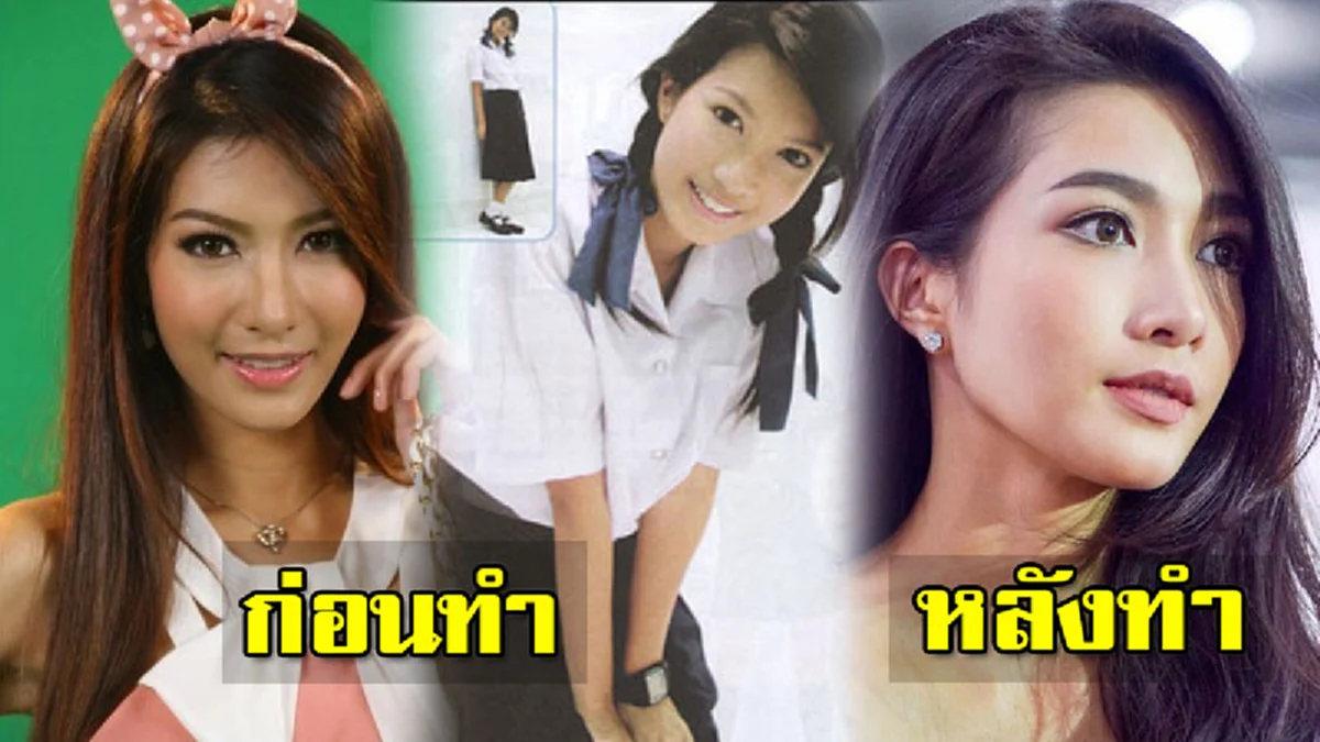 *เกือบทั้งประเทศไม่เคยรู้!!! เผยโฉมหน้า "2ซุปตาร์สาว" ดีกรีนางร้าย-นางเอกชื่อดัง ที่สารภาพผ่านสื่อ เคย "เหลาจมูกออก" ให้เล็กลง!!! (เนื้อหา)