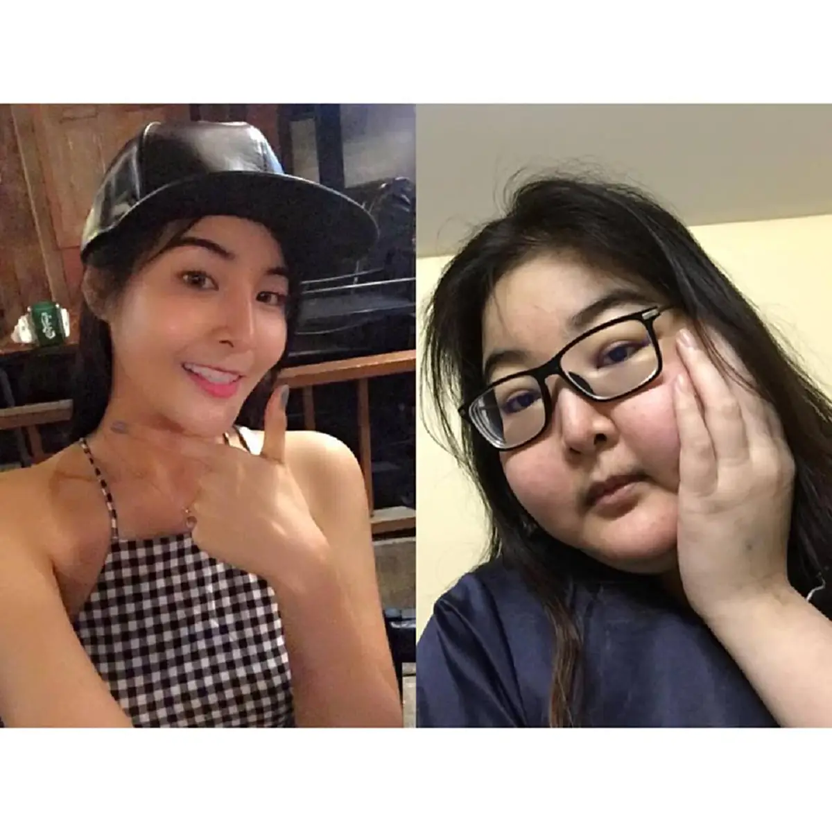 สาวสวยเล่าอุทาหรณ์ป่วยโรคลิ่มเลือดอุดตันในสมอง จนรูปร่างหน้าตาเปลี่ยน