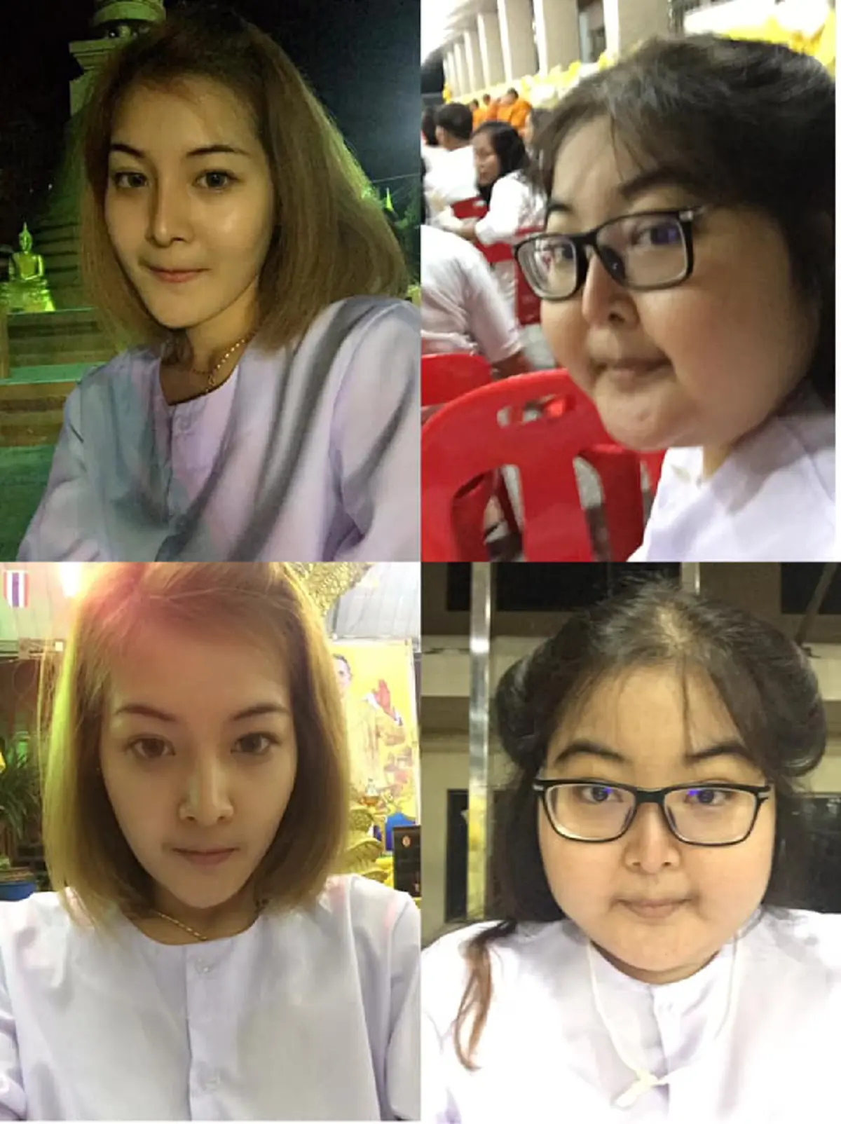 สาวสวยเล่าอุทาหรณ์ป่วยโรคลิ่มเลือดอุดตันในสมอง จนรูปร่างหน้าตาเปลี่ยน