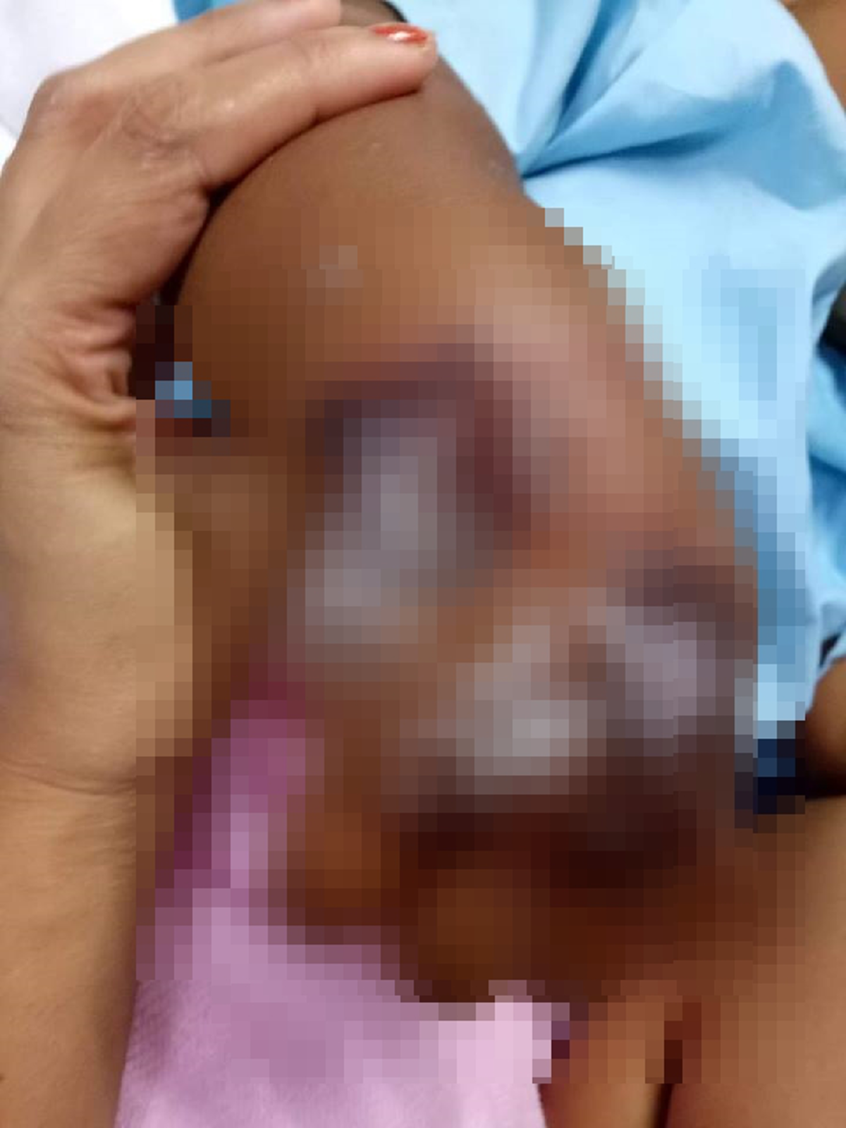 พ่อร้องทุกข์ลูกชายให้น้ำเกลือแขนบวม