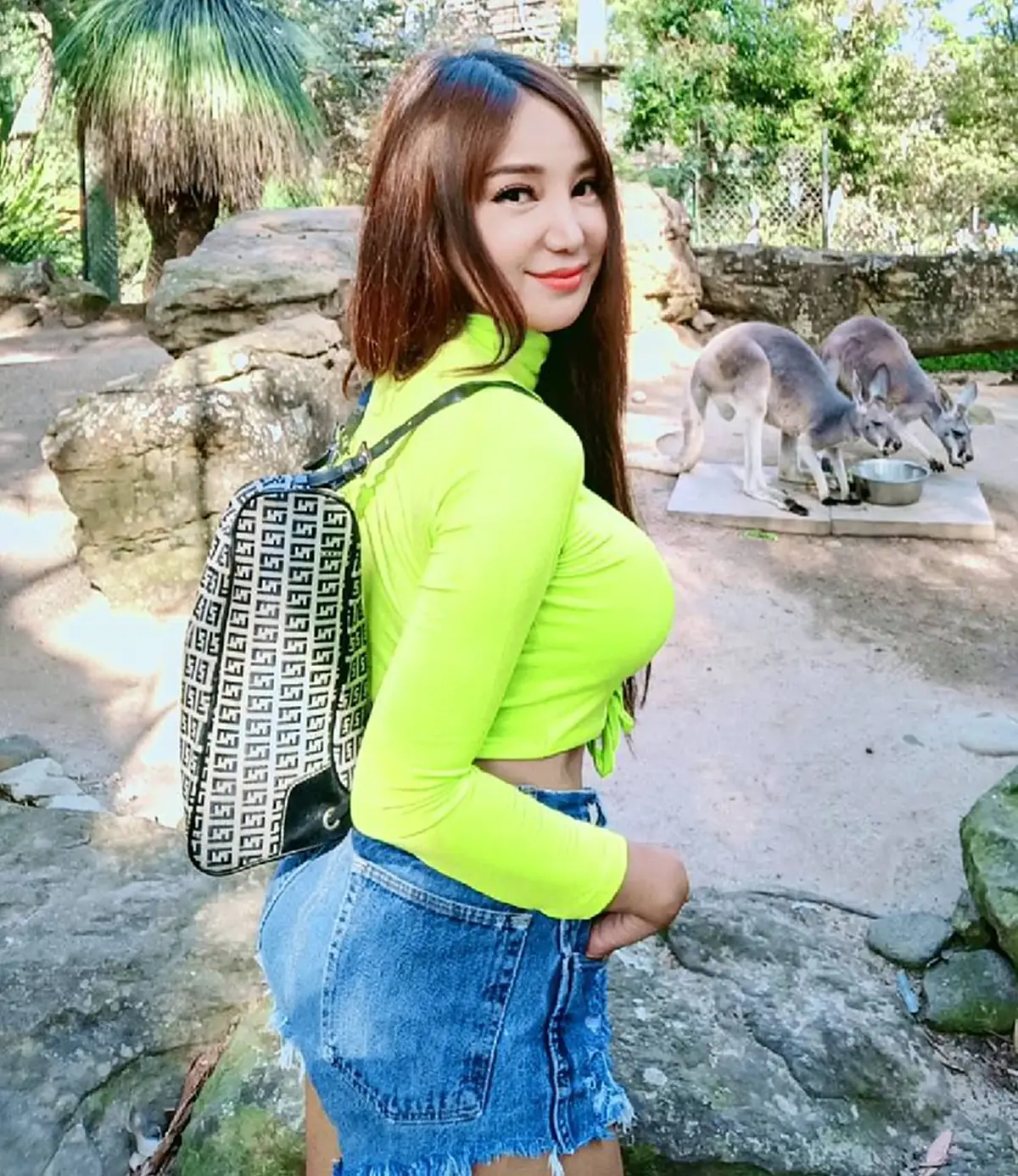 เปิ้ล ไอริณ เขียนพินัยกรรมหลังป่วยหัวใจเต้นผิดจังหวะ