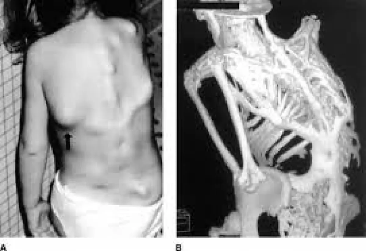 แพทย์ย้ำหนัก!!! ปวดหลังอย่าชะล่าใจ นี้คือสัญญาณเตือนจากร่างกาย รู้ทันโรค อ่านด่วน!!!