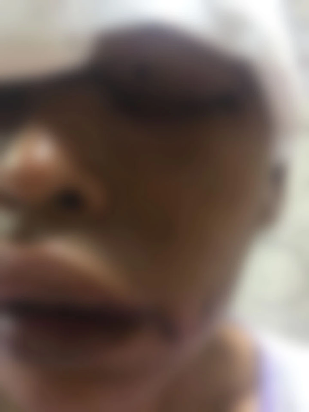 สาวเกิดอุบัติเหตุ กระจกเข้าตา โร่หา "หมอ" แต่สุดท้ายแค่เย็บแผลให้