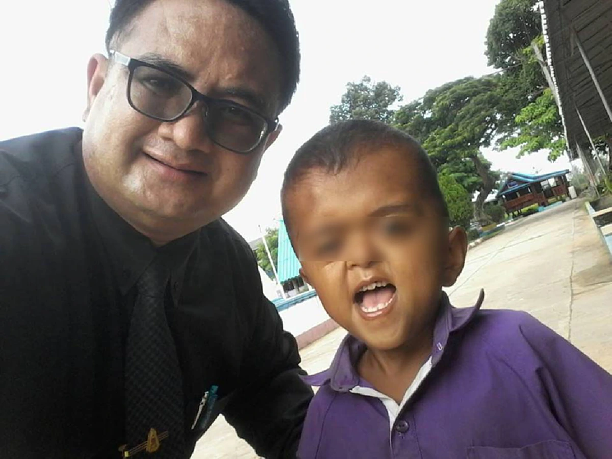 อนิจจาชีวิต!! น้องอิคคิว นักเรียนชั้นป.1พิการซ้ำซ้อน นิ้วมือนิ้วเท้าติดกันแต่กำเนิดแม่เสียตั้งแต่แรกคลอด เพื่อนบ้านเวทนาปลูกเพิงพักกันแดดฝน