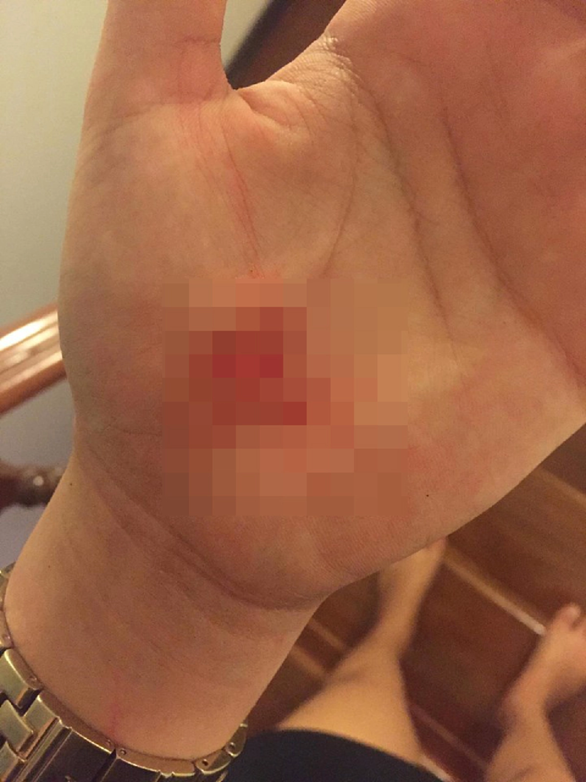 สาวสุดทน โพสต์ประจาน แฟนหนุ่มทำร้ายร่างกาย จับได้พาผู้หญิงมามีอะไรกันที่บ้าน แถทุกครั้งไม่ยอมรับ ล่าสุดไม่ทนแล้ว!