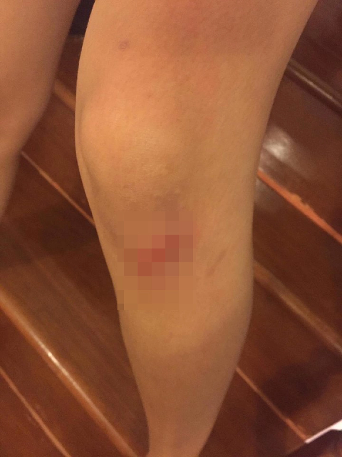 สาวสุดทน โพสต์ประจาน แฟนหนุ่มทำร้ายร่างกาย จับได้พาผู้หญิงมามีอะไรกันที่บ้าน แถทุกครั้งไม่ยอมรับ ล่าสุดไม่ทนแล้ว!