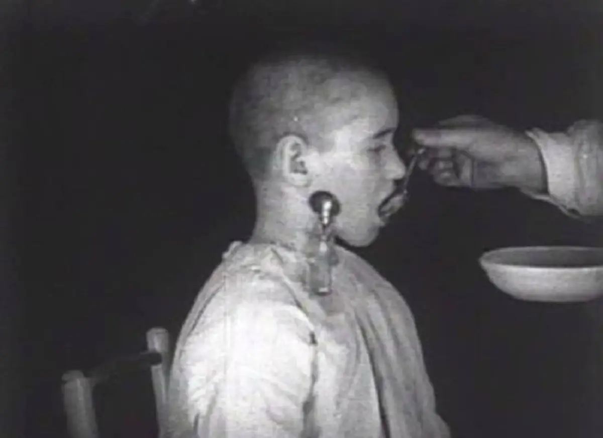 น่ากลัวสุดขีด !! นี่คือ "สภาพของคน" ที่ "อดนอน 15 วันเต็ม" จากคนปกติ..กลายเป็นปีศาจ เห็นแล้วขนลุกซู่ !! (ชมภาพ)