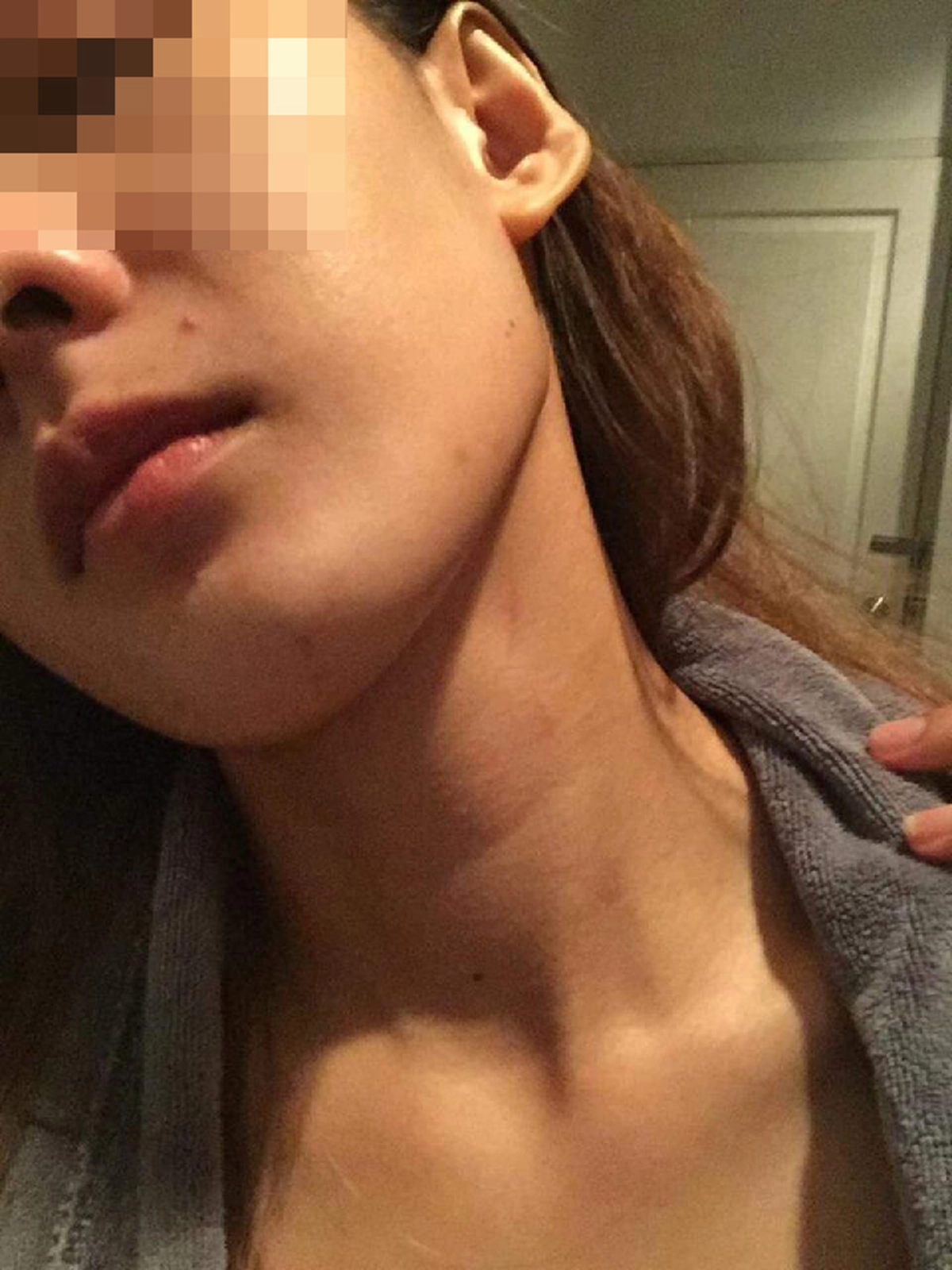 สาวสุดทน โพสต์ประจาน แฟนหนุ่มทำร้ายร่างกาย จับได้พาผู้หญิงมามีอะไรกันที่บ้าน แถทุกครั้งไม่ยอมรับ ล่าสุดไม่ทนแล้ว!