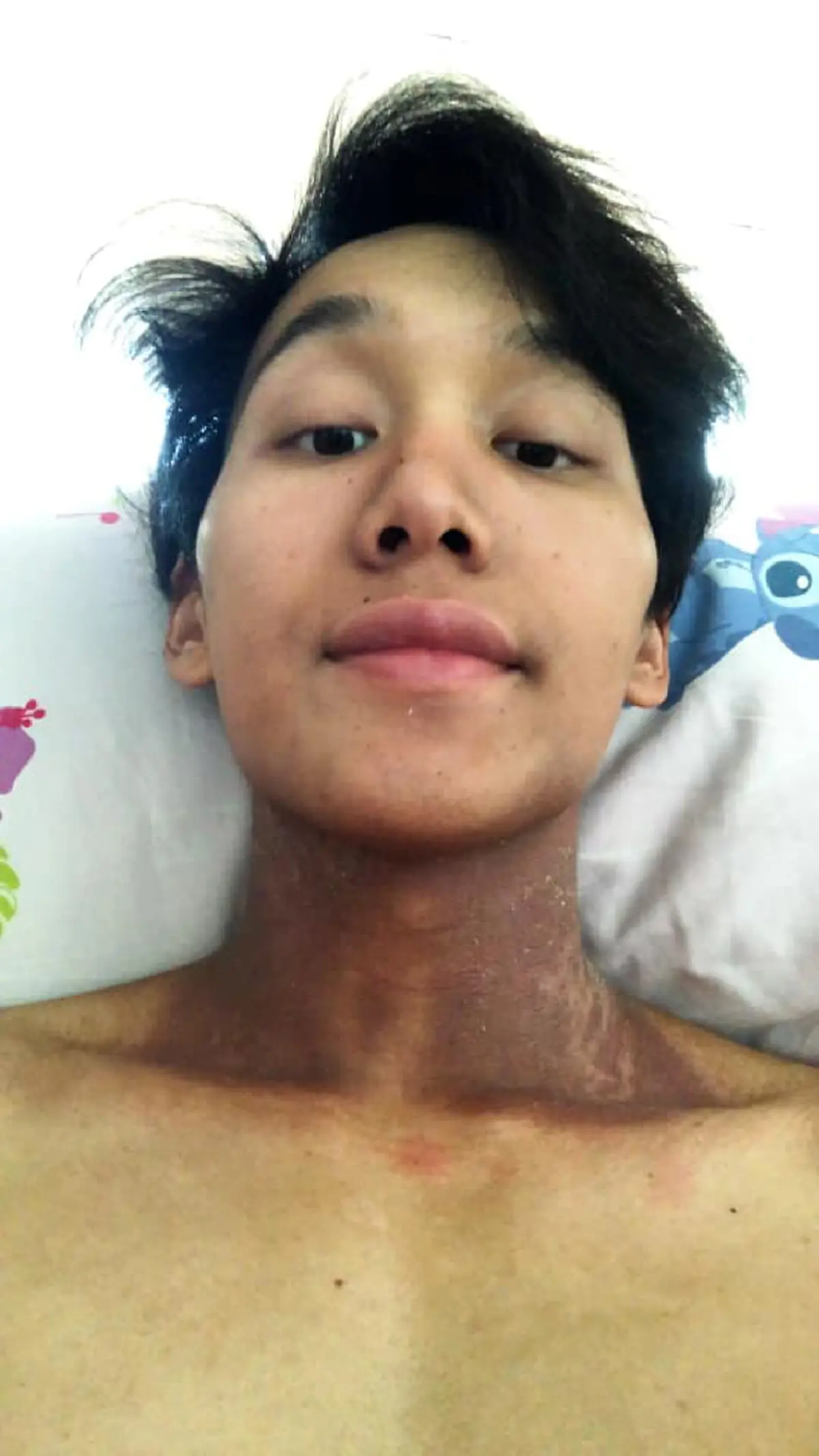 หนุ่มเล่าประสบการณ์เป็นมะเร็งหลังโพรงจมูก กับชีวิตที่เปลี่ยนไป