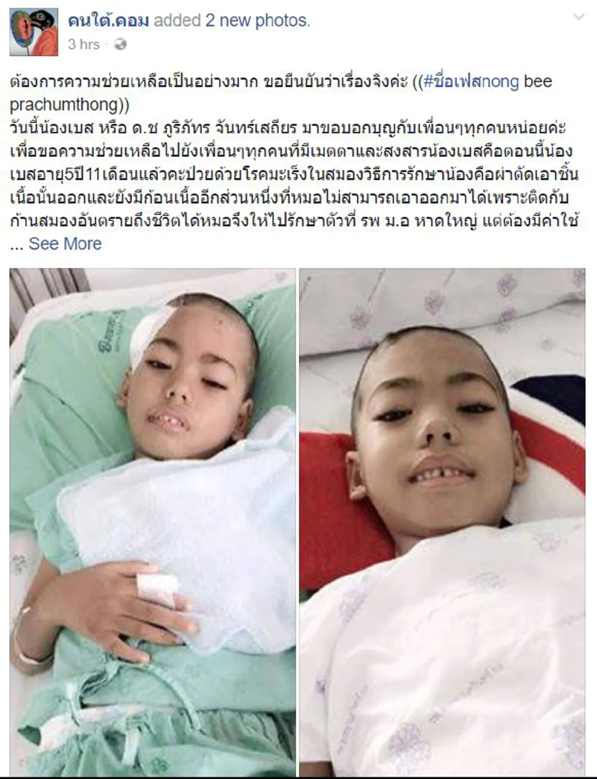 น้ำใจคนไทยไม่ทิ้งกัน !! "หนูน้อย"สุดน่าสงสาร..เผชิญโรคมะเร็งสมอง..เนื้อร้ายติดก้านสมองอันตรายถึงชีวิต..วอนผู้ใจบุญเมตตาช่วยเหลือ(รายละเอียด)